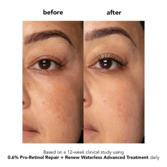 đ„3/$30 NEW Boscia 0.6% Pro-Retinol Repair + Renew Treatment Full Size $48.00 - Picture 13 of 14